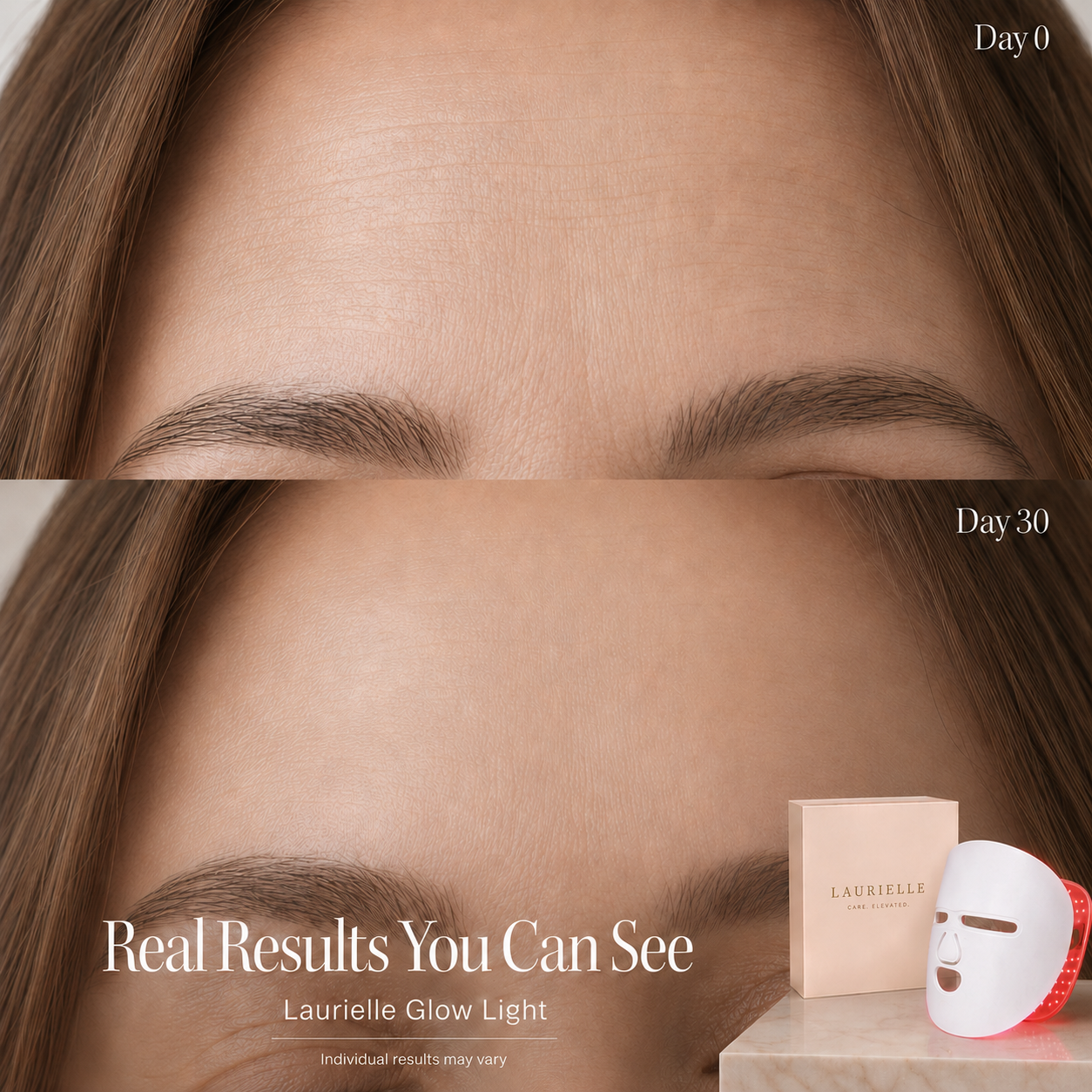 Before and after comparison of skin treatment with Lauriele Glow Light product shown.